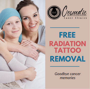 Free Radiotherapy Tattoo Removal