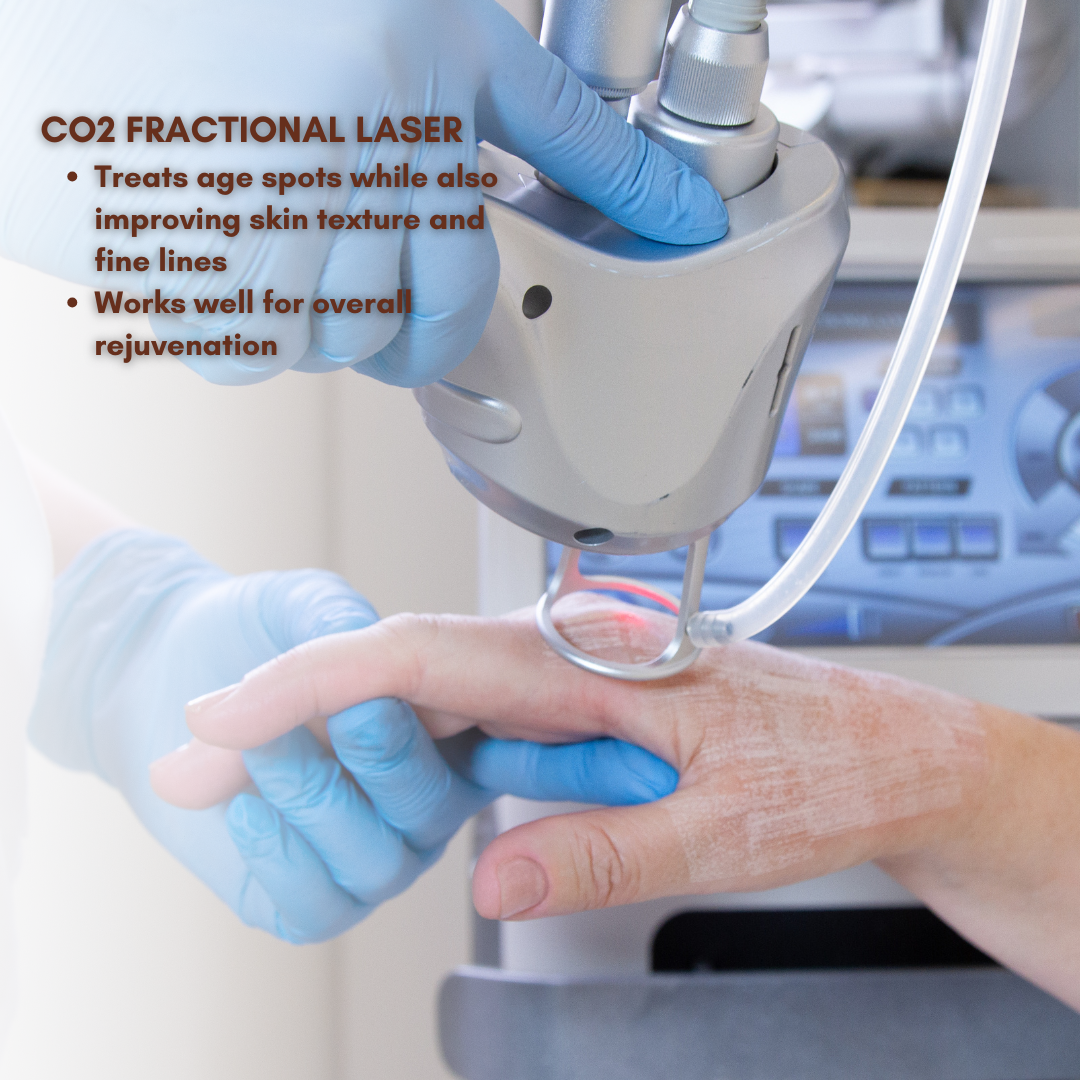 7 Benefits of CO2 Laser Skin Resurfacing