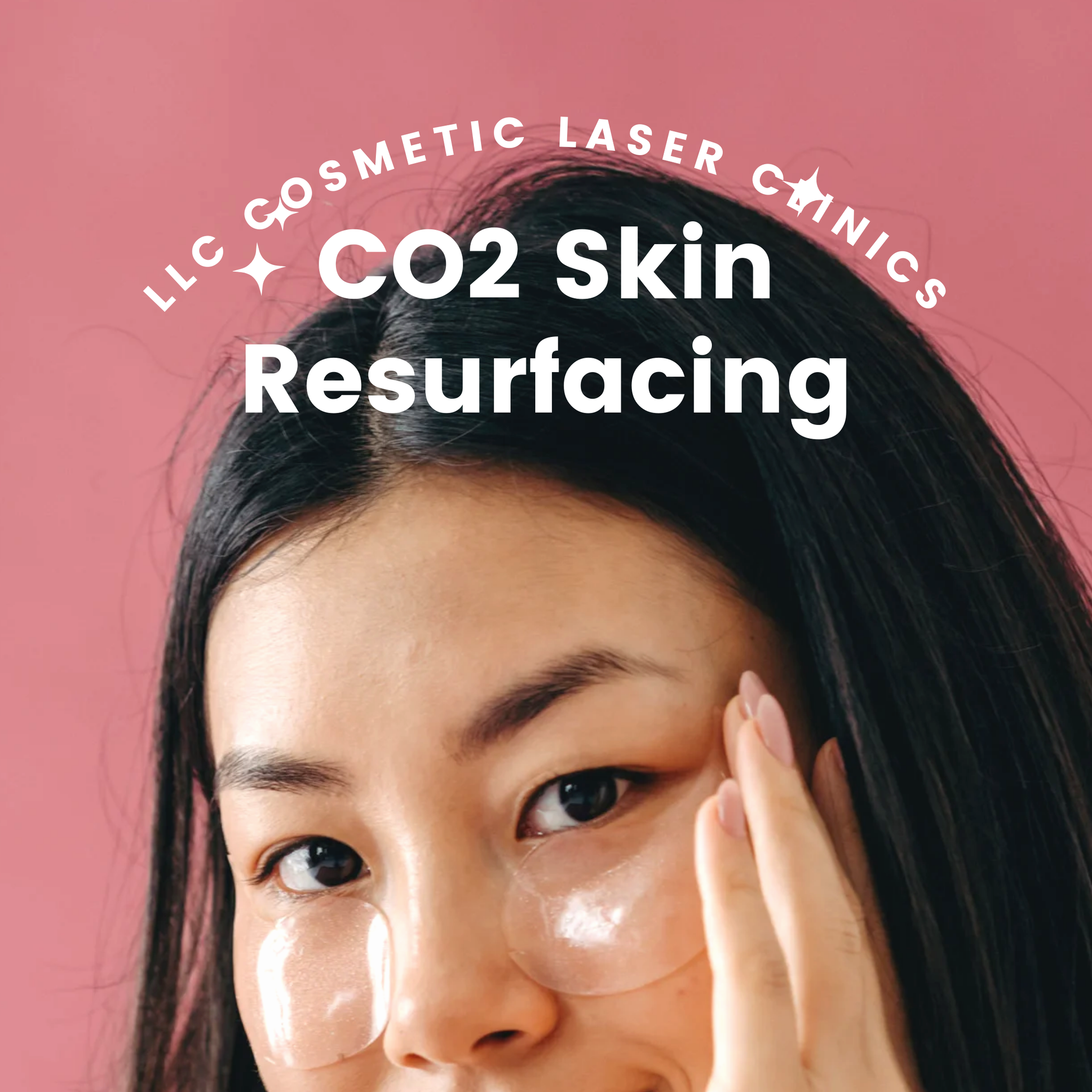 CO2 Laser Resurfacing: What Goes Down During Your Treatment Session?
