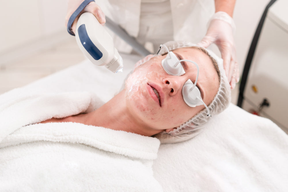 Laser Treatment for Acne