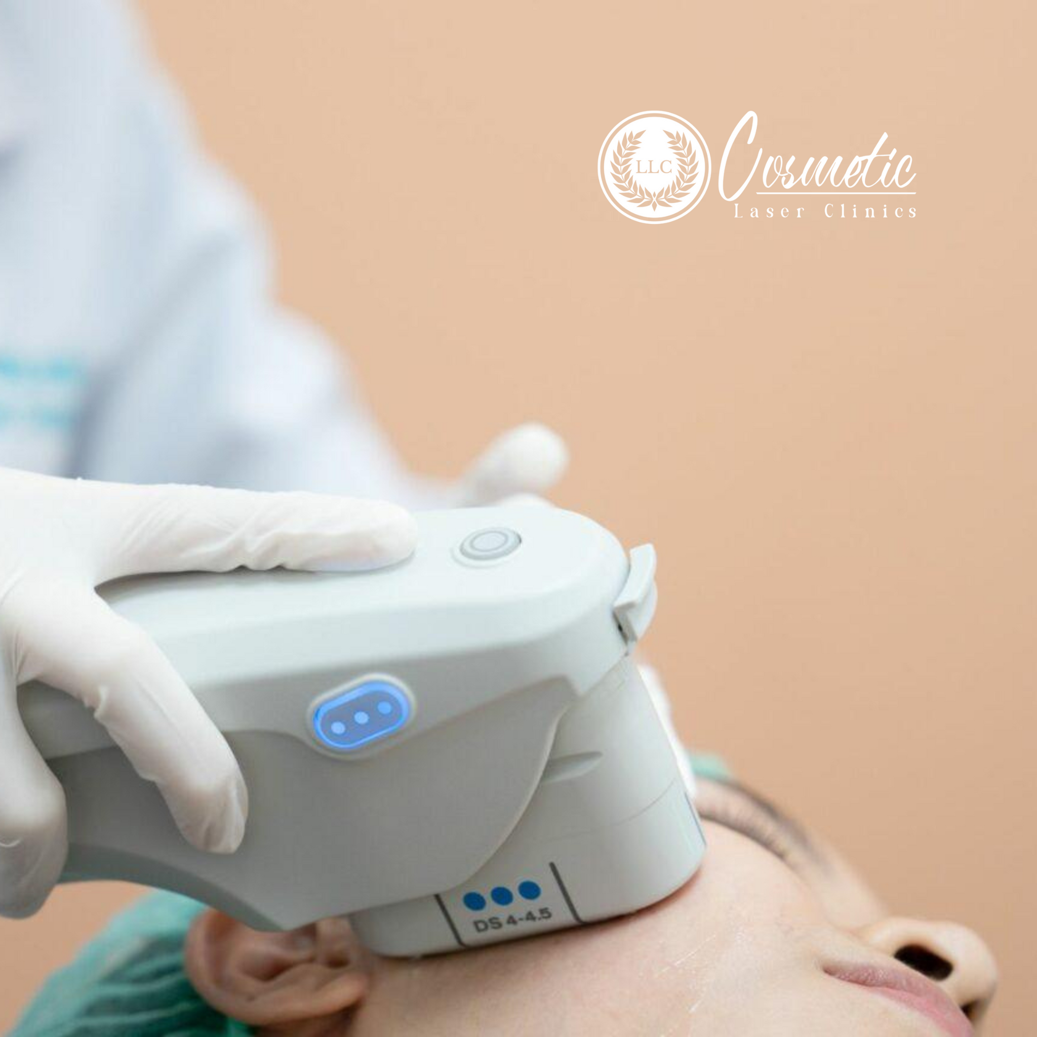 Discover the Best HIFU Options Nearby!