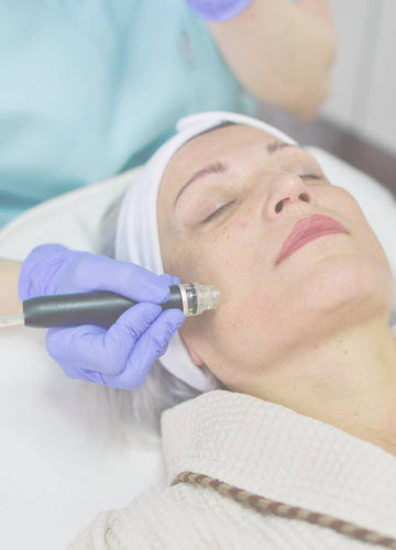 hydrodermabrasion treatment