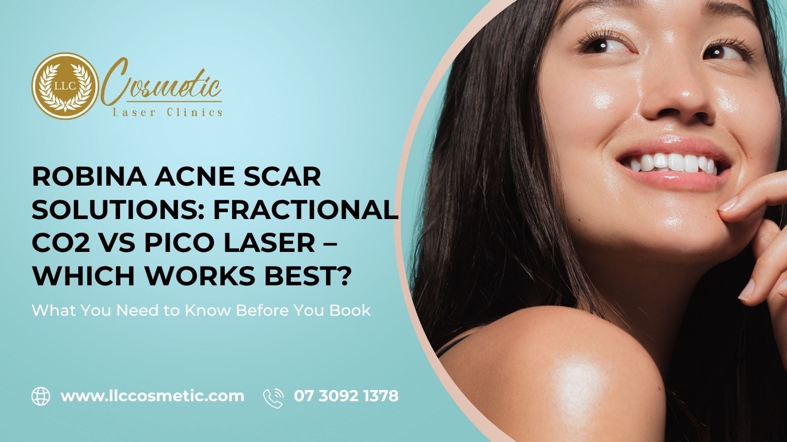 Robina Acne Scar Solutions, Fractional CO2, Pico Laser, Which Works Best?