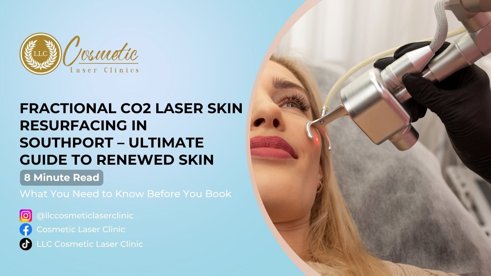 Fractional CO2 Laser Skin Resurfacing, Southport – Ultimate Guide to Renewed Skin