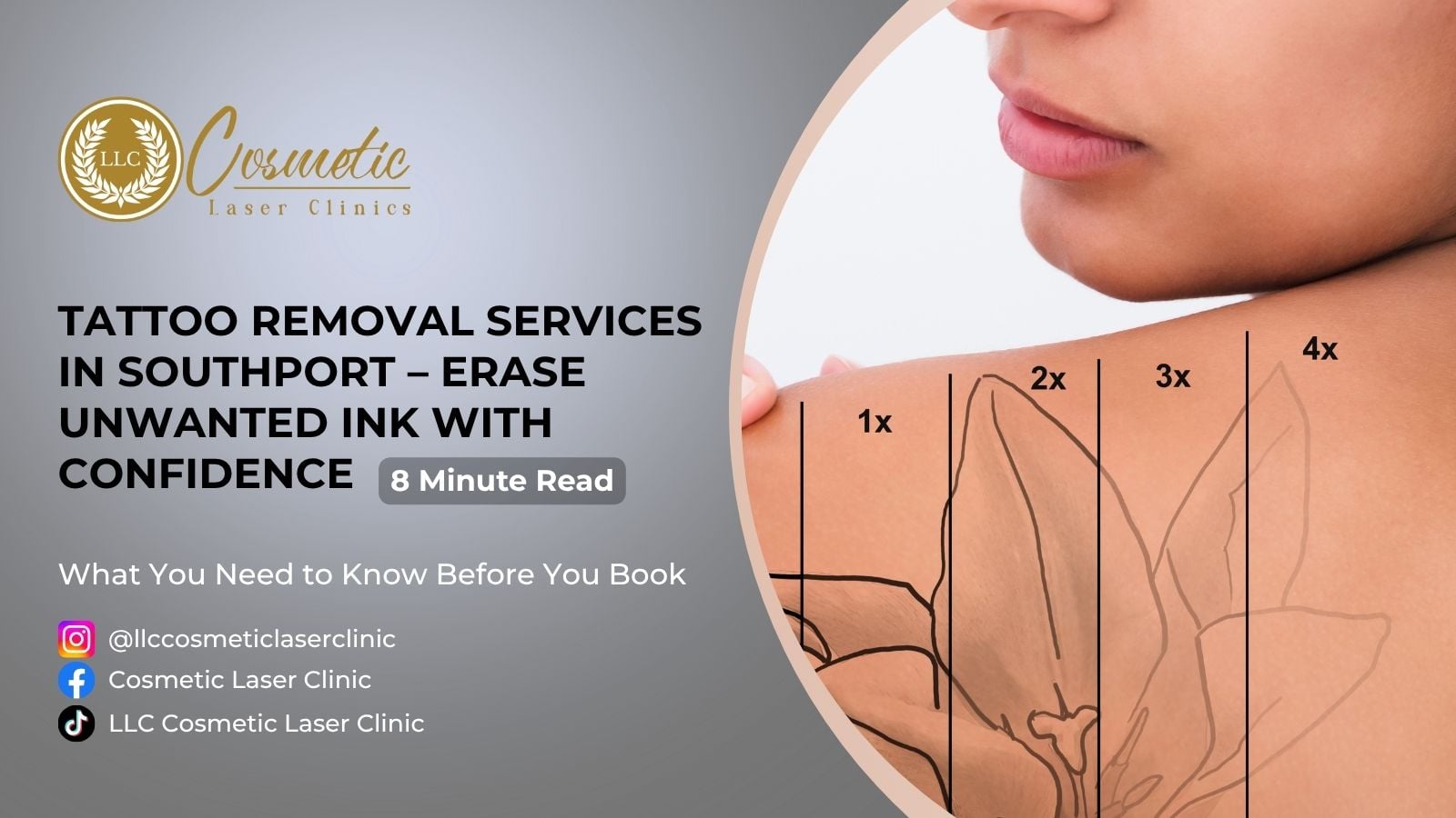 Tattoo Removal Services in Southport – Erase Unwanted Ink with Confidence