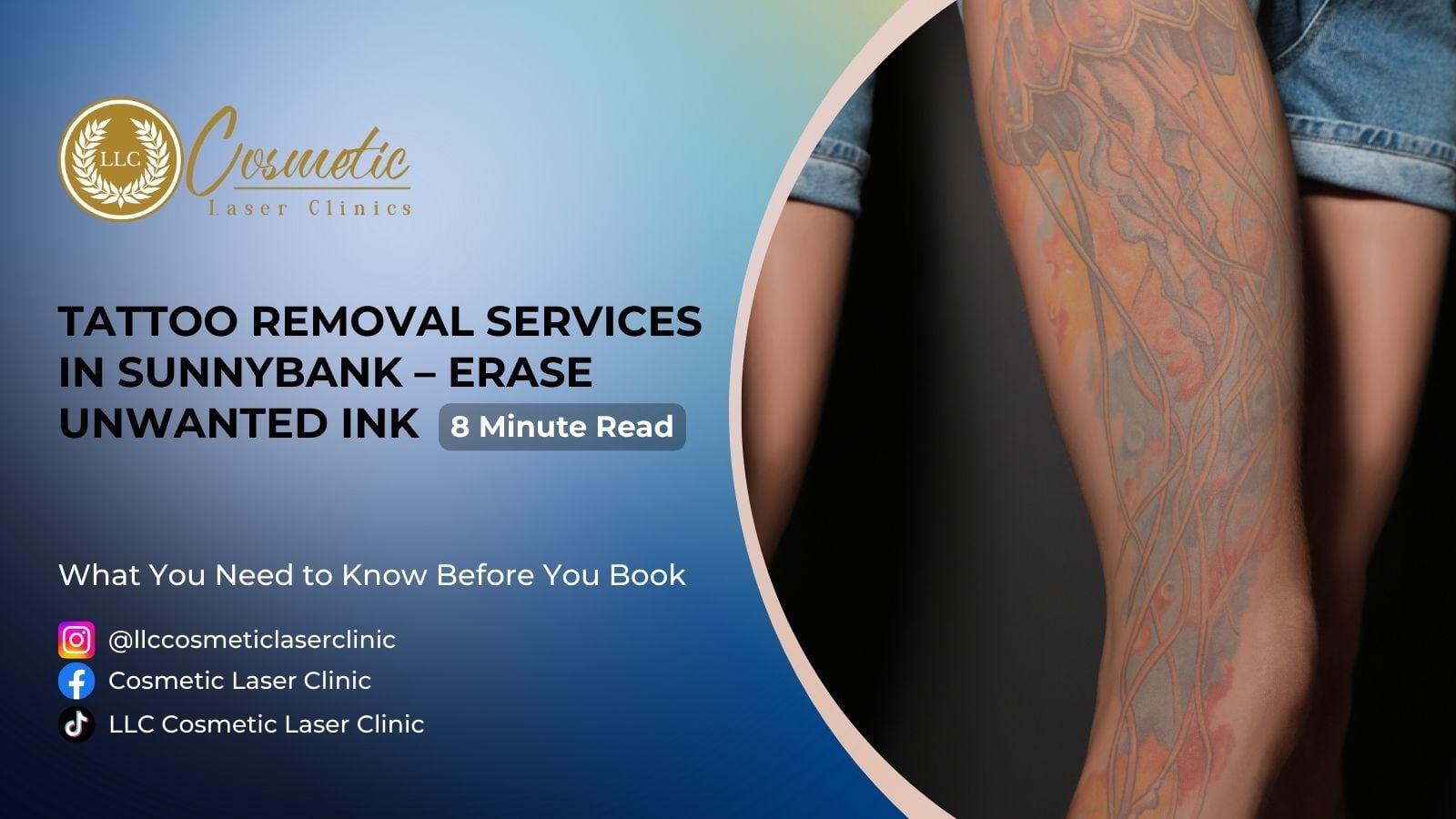 Tattoo Removal