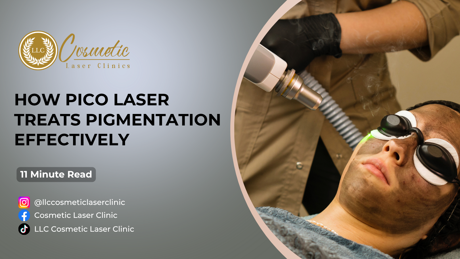 How Pico Laser Treats Pigmentation Effectively