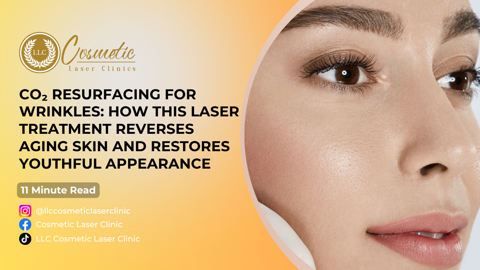 CO₂ Resurfacing for Wrinkles: How This Laser Treatment Reverses Aging Skin and Restores Youthful Appearance- Brisbane, Sunnybank, Southport, Robina