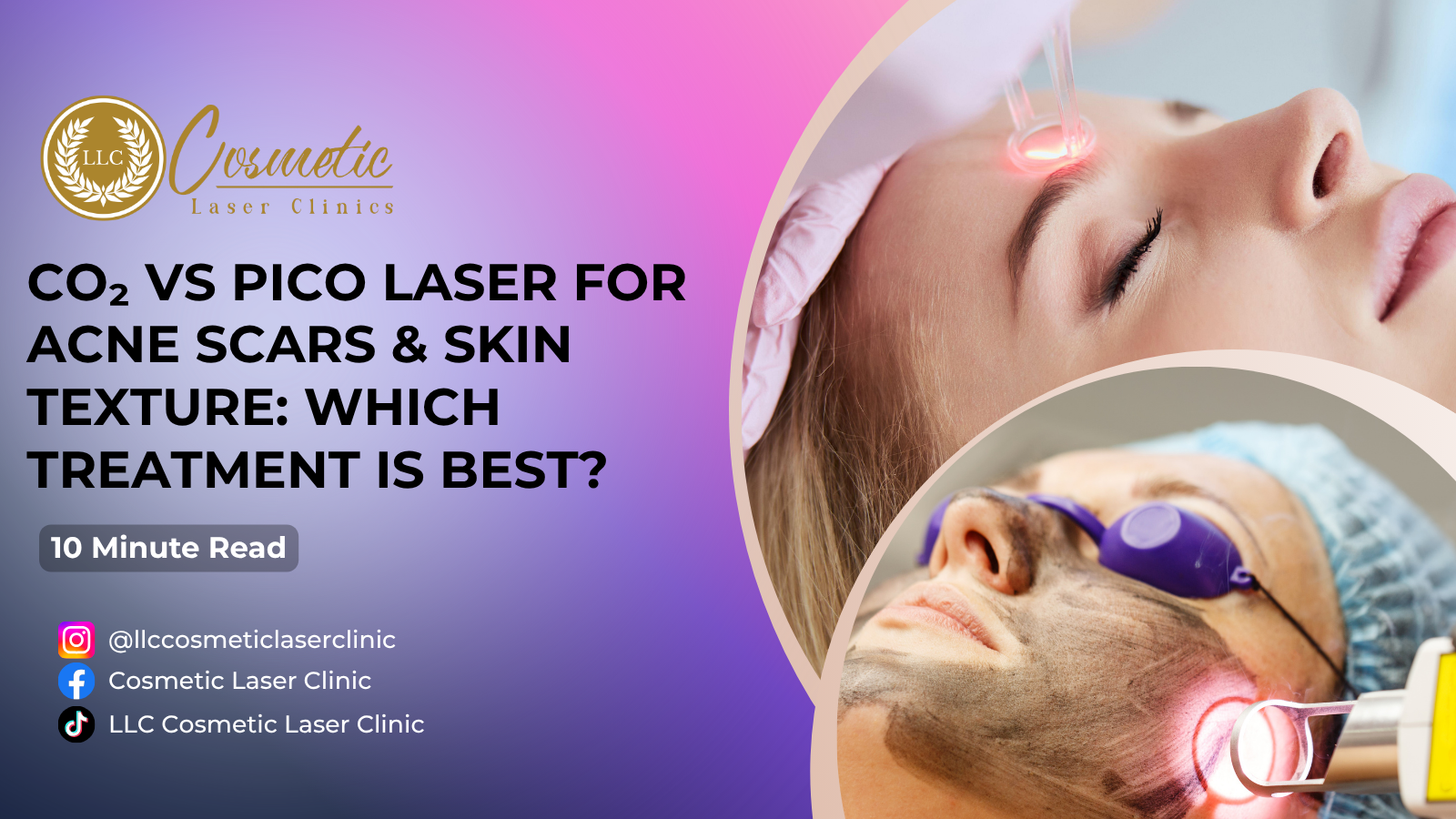 CO₂ vs PICO Laser for Acne Scars & Skin Texture: Which Treatment Is Best in Brisbane, Sunnybank, Southport, Robina?