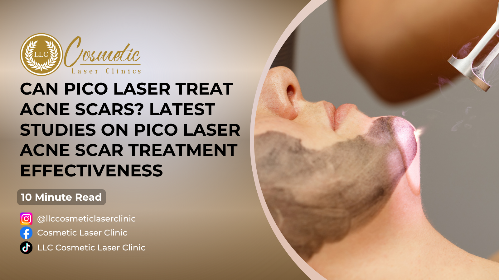 Can PICO Laser Treat Acne Scars? Latest Studies on Pico Laser Acne Scar Treatment Effectiveness- Brisbane, Sunnybank, Southport, Robina
