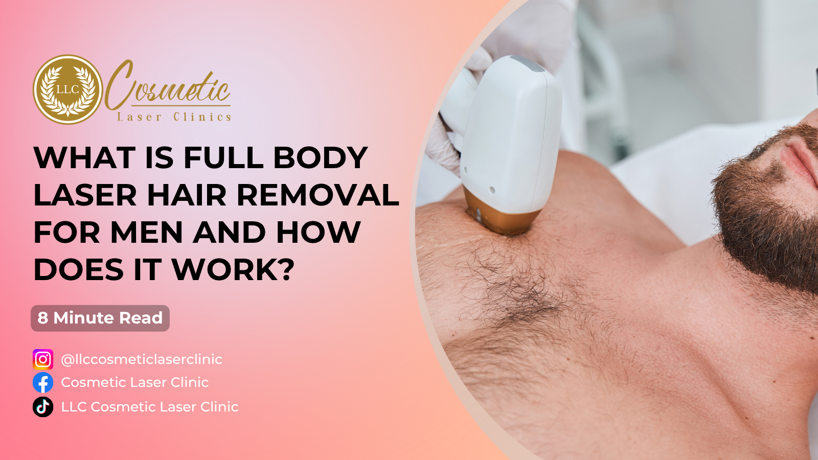 Men’s Full Body Laser Hair Removal: The Complete Guide to Costs, Results, Preparation, and What to Expect in Brisbane, Sunnybank, Southport, Robina