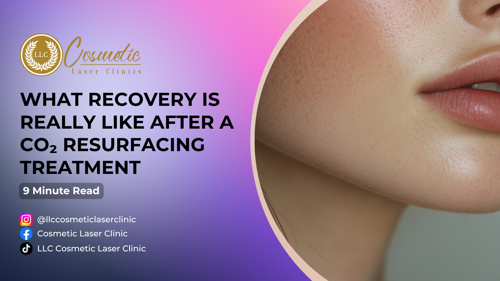 What Recovery Is Really Like After a CO₂ Resurfacing Treatment: Complete Timeline and Aftercare Guide Brisbane, Sunnybank, Southport, Robina