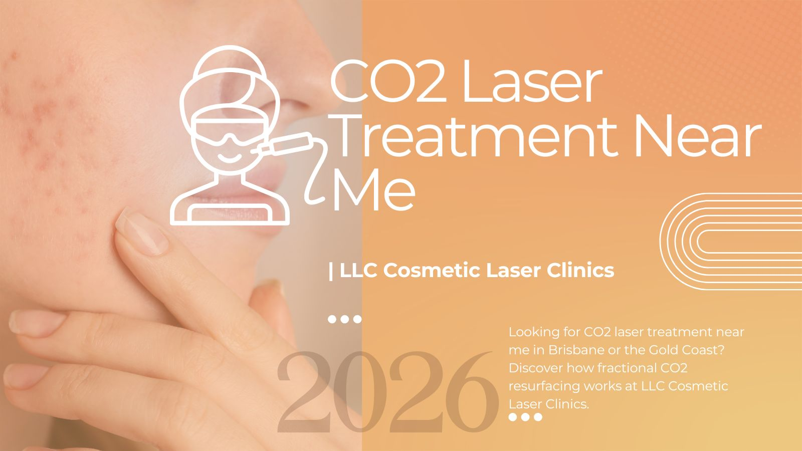 CO2 laser treatment near me &mdash; professional skin resurfacing at LLC Cosmetic Laser Clinics Brisbane and Gold Coast