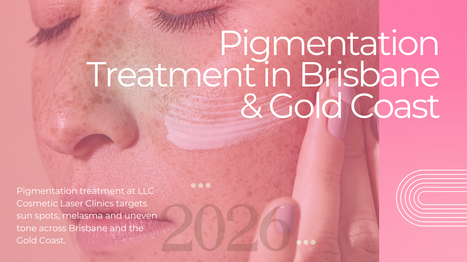Pigmentation treatment at LLC Cosmetic Laser Clinics in Brisbane and the Gold Coast