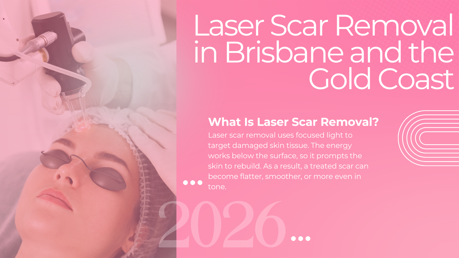 Laser scar removal treatment at LLC Cosmetic in Brisbane
