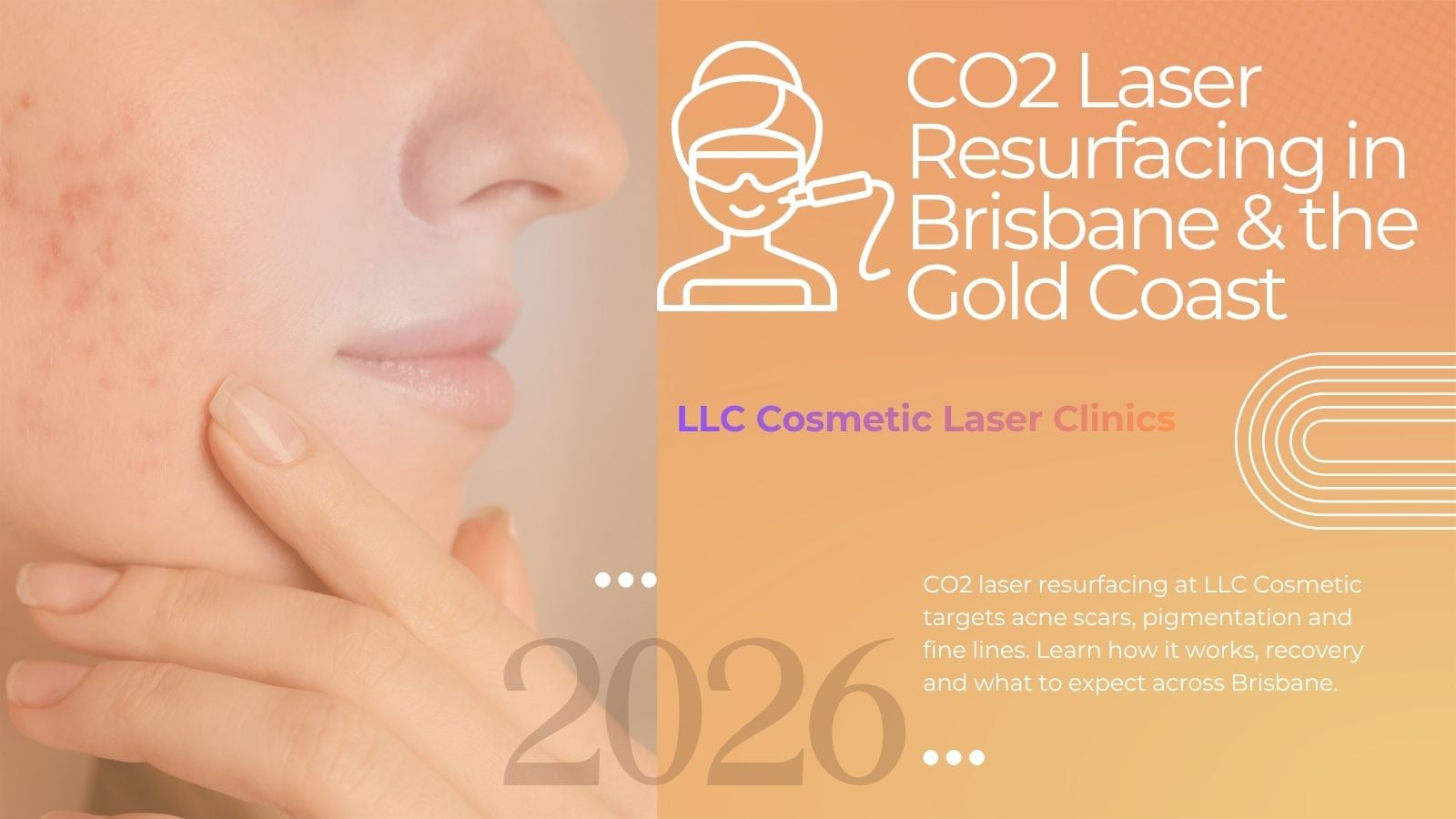CO2 laser resurfacing treatment at LLC Cosmetic Laser Clinics in Brisbane