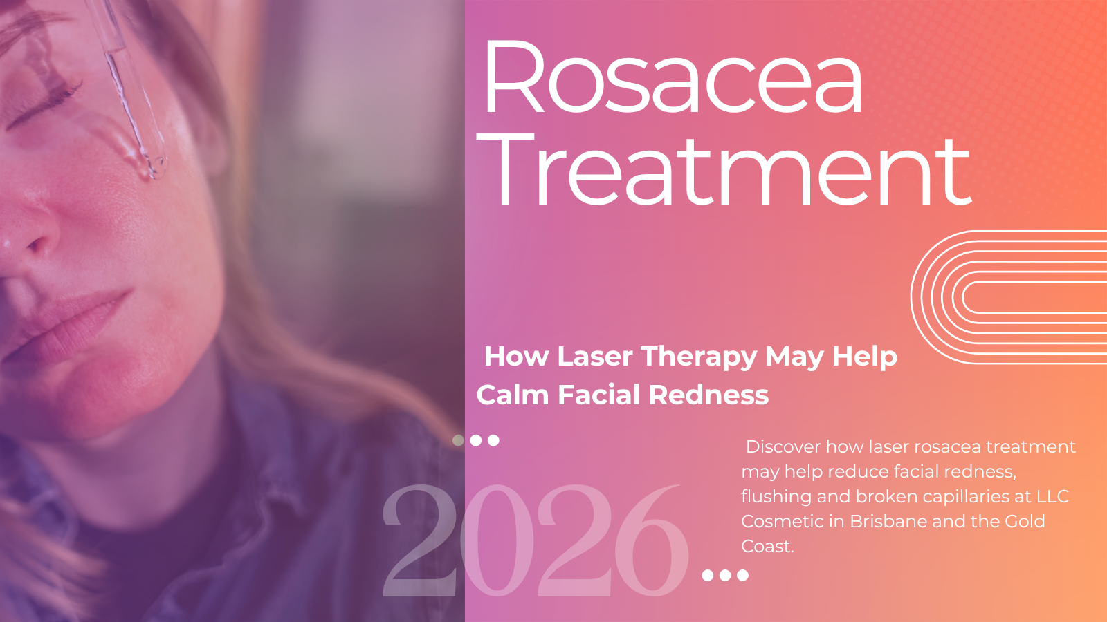 Laser rosacea treatment for facial redness at LLC Cosmetic Laser Clinics Brisbane and Gold Coast